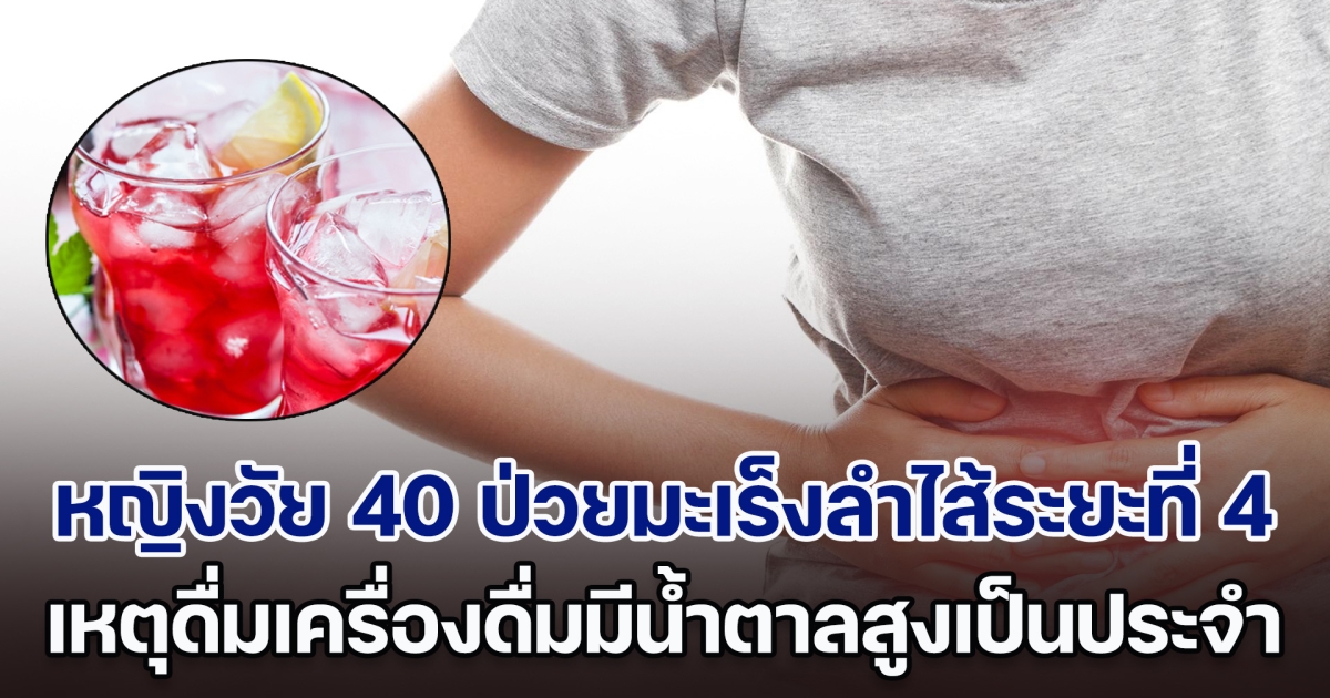 สายน้ำหวานระวังไว้! หญิงวัย 40 ป่วยมะเร็งลำไส้ระยะที่ 4 เหตุดื่มเครื่องดื่มที่มีน้ำตาลสูงเป็นประจำ (ตปท.)