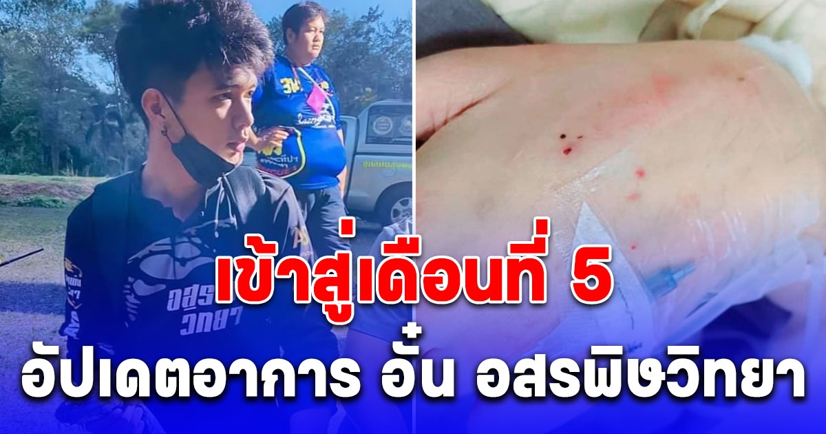 เข้าสู่เดือนที่ 5 อัปเดตอาการ อั๋น อสรพิษวิทยา หลังถูกงูจงอางกัด