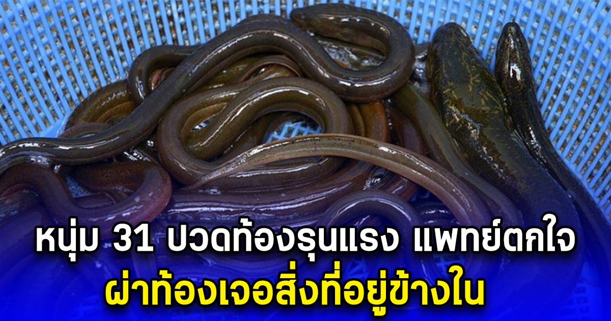 หนุ่ม 31 ปวดท้องรุนแรง แพทย์ตกใจ ผ่าท้องเจอสิ่งที่อยู่ข้างใน