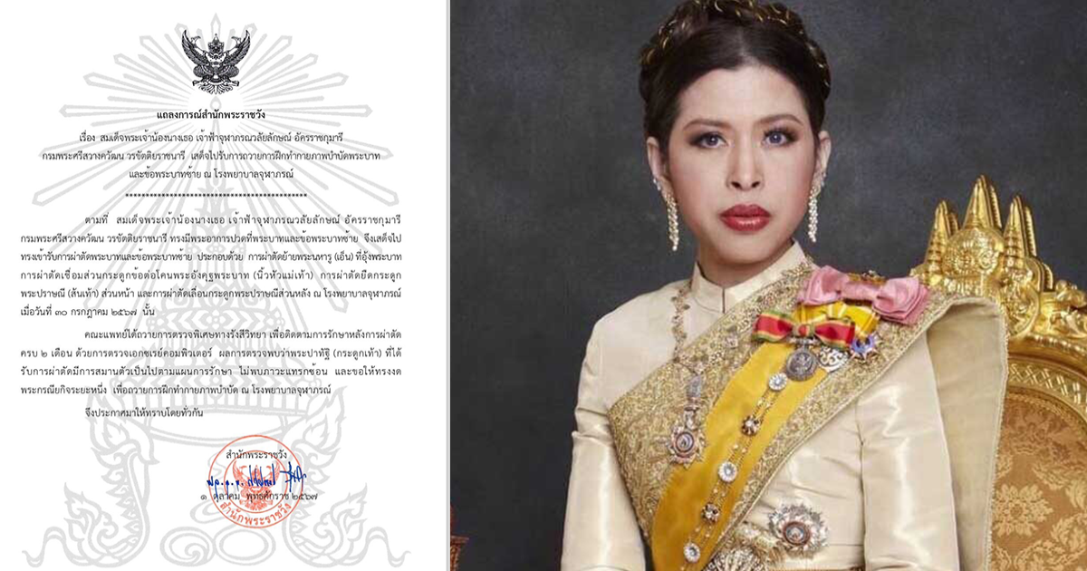 แถลงการณ์สำนักพระราชวัง กรมพระศรีสวางควัฒนฯ เสด็จไปรับการถวายการฝึกทำกายภาพบำบัดพระบาทและข้อพระบาทซ้าย คณะแพทย์ขอให้ทรงงดพระกรณียกิจระยะหนึ่ง