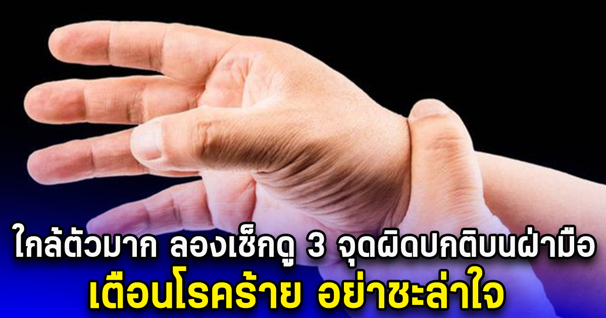 ใกล้ตัวมาก ลองเช็กดู 3 จุดผิดปกติบนฝ่ามือ เตือนโรคร้าย อย่าชะล่าใจ