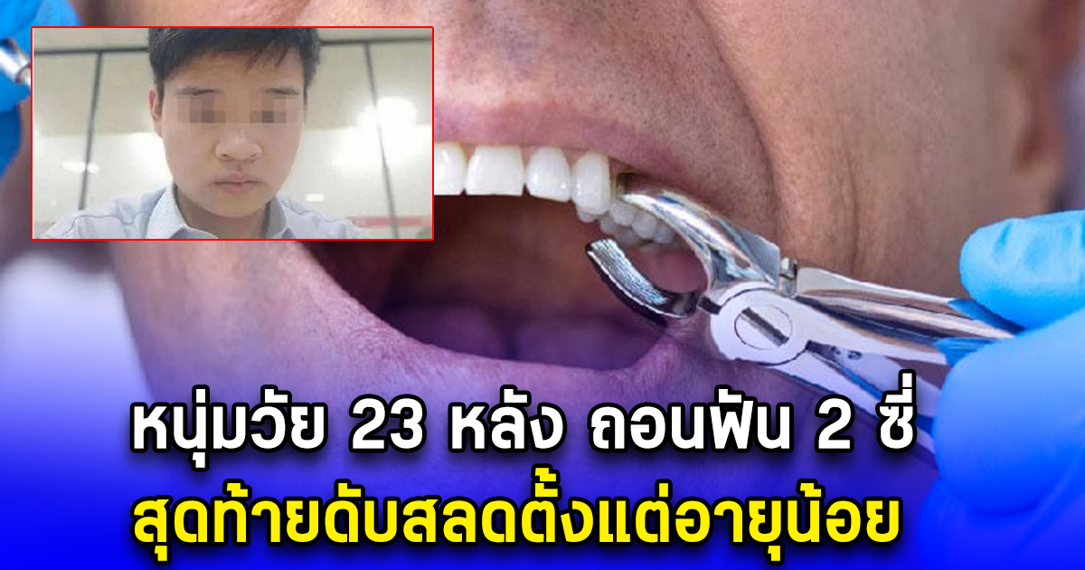 หนุ่มวัย 23 หลัง ถอนฟัน 2 ซี่ สุดท้ายดับสลดตั้งแต่อายุน้อย