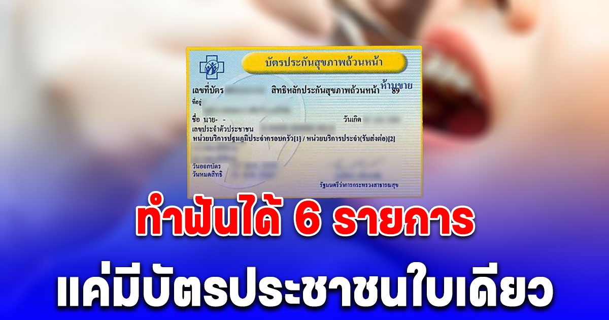 บัตรทอง 30 บาท ใช้สิทธิทำฟันฟรีได้ 6 รายการ คลินิกใกล้บ้าน 1,394 แห่ง แค่มีบัตรประชาชนใบเดียว