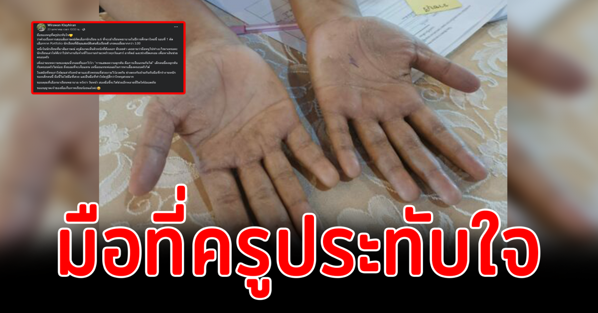 ครูเผยภาพมือนักเรียน สอบสัมภาษณ์เรียนพยาบาล