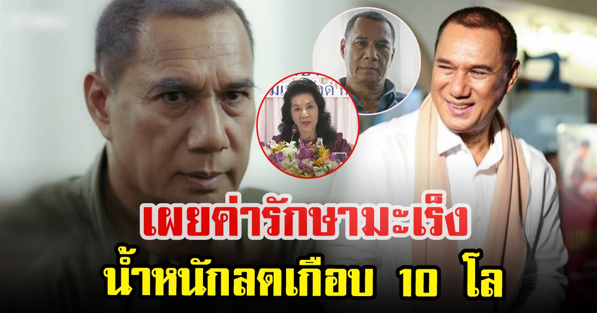 เปิดค่ารักษา สรพงษ์ ชาตรี