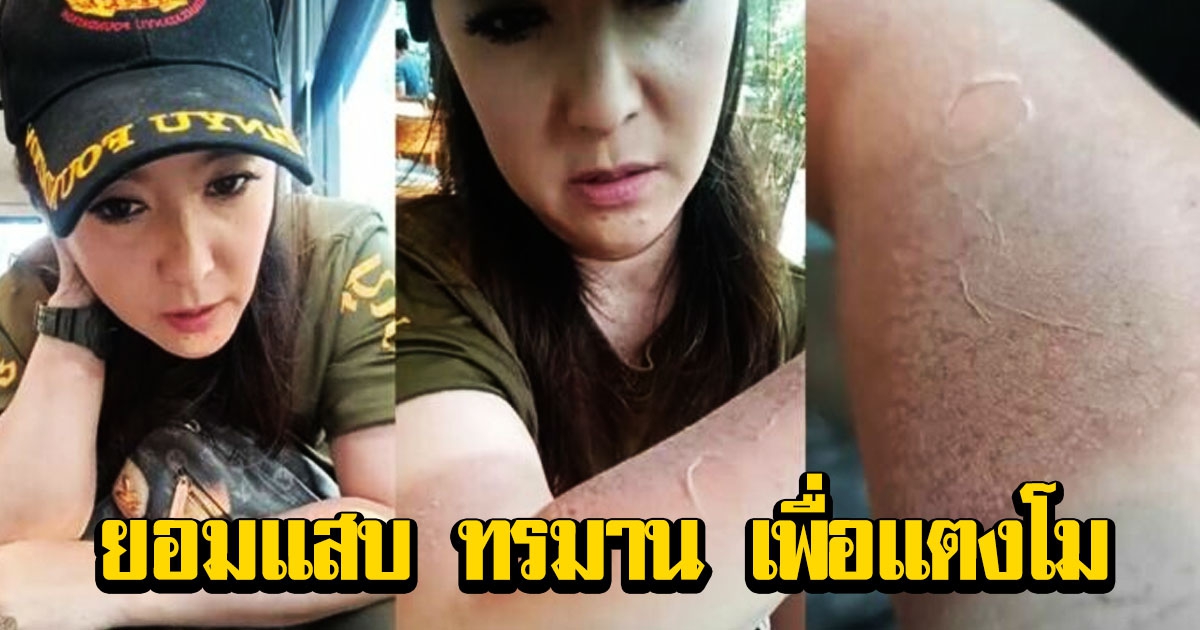 สายธาร โชว์แขน เผยความรู้สึกทำเพื่อแตงโม