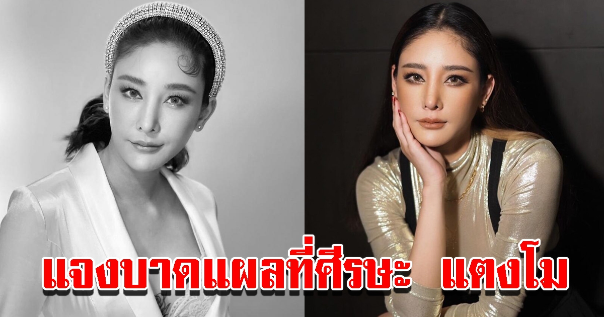 จ่อเรียกแพทย์ผ่าร่าง แตงโม นิดา ชี้แจงบาดแผลที่ศีรษะ