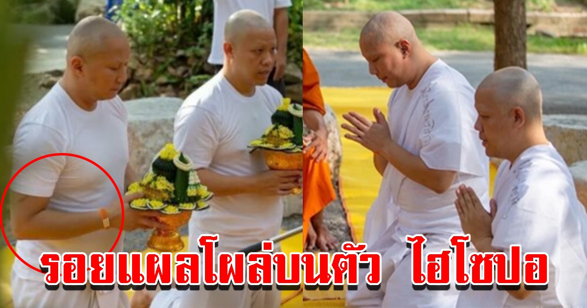 ชาวโซเชียลซูมรอยบนตัว ไฮโซปอ