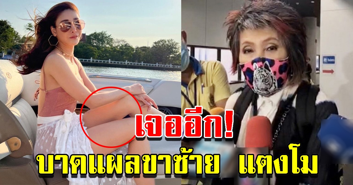 หมอพรทิพย์ เผยเจอบาดแผลที่ต้นขาซ้ายของ แตงโม