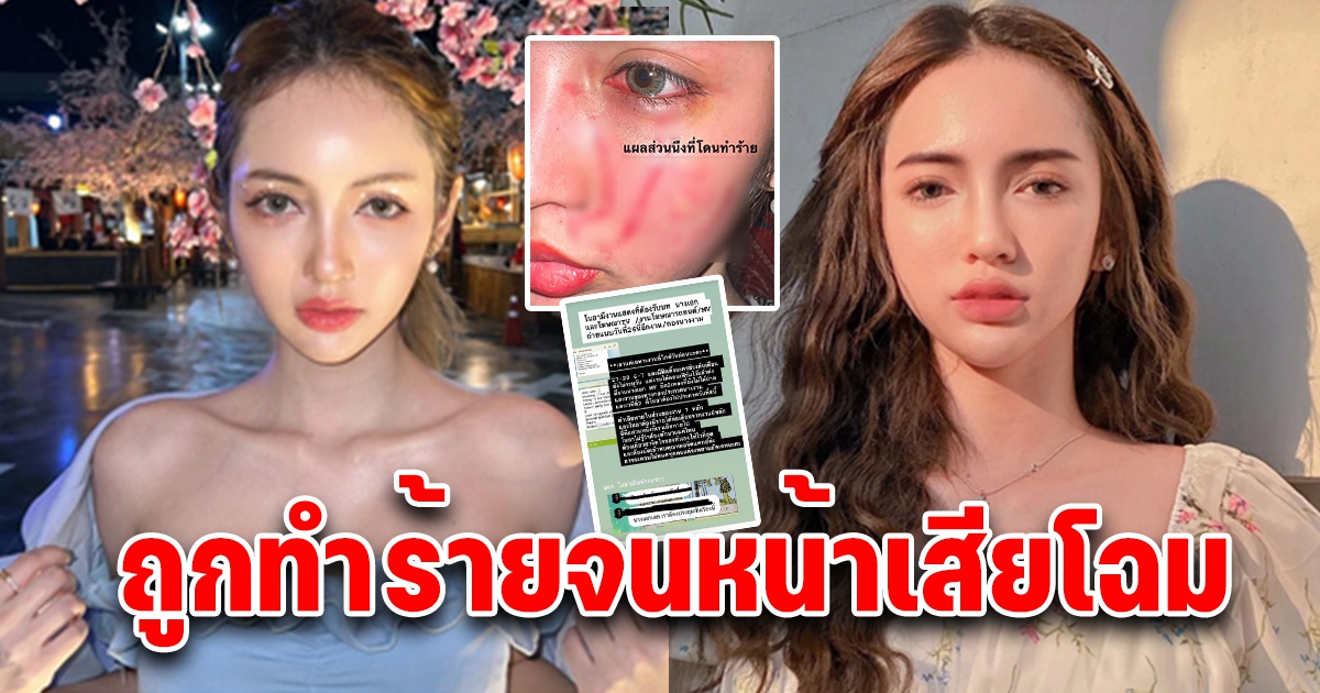 โนอา ภญมณ ว่าที่นางเอก ถูก 2 ไอดอลสาวผู้ติดตามหลักแสนรุมทำร้ายเสียโฉม