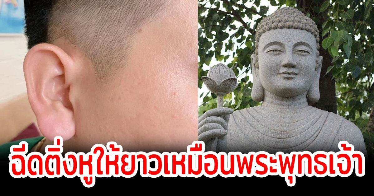 เทรนด์มาแรงในเวียดนาม แห่ใช้ฟิลลิงติ่งหูให้เหมือนพระพุทธเจ้า