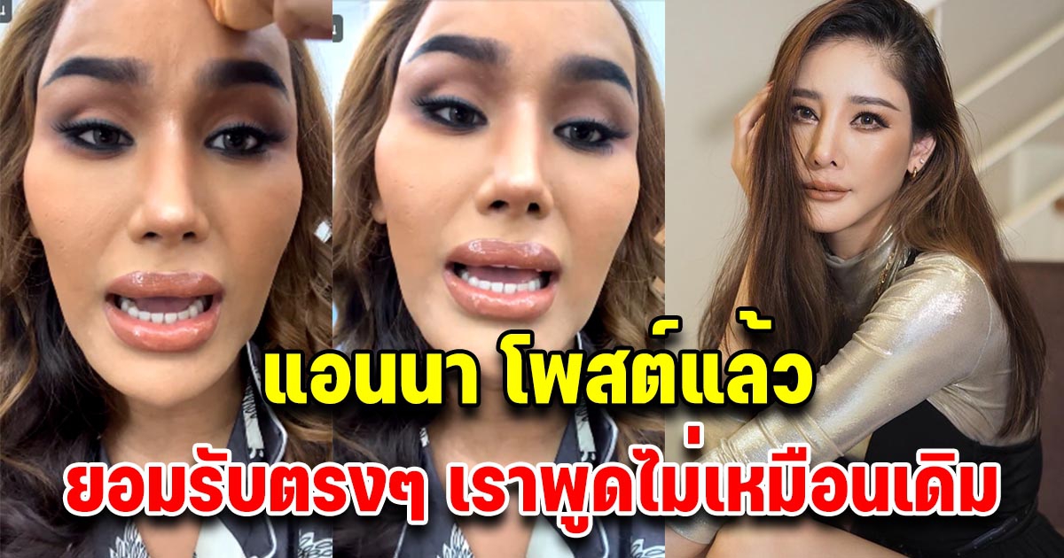 แอนนา โพสต์แล้ว หลังโซเชียลสงสัย ทำไมพูดไม่เหมือนเดิม วันที่เจอแตงโม