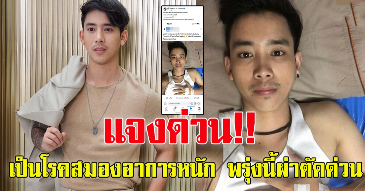 เบิ้ล ปทุมราช แจงด่วน หลังลือ เป็นโรคสมองอาการหนัก