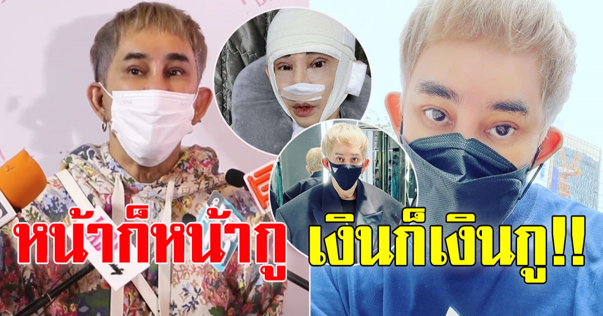 พจน์ อานนท์ ทำหน้าใหม่