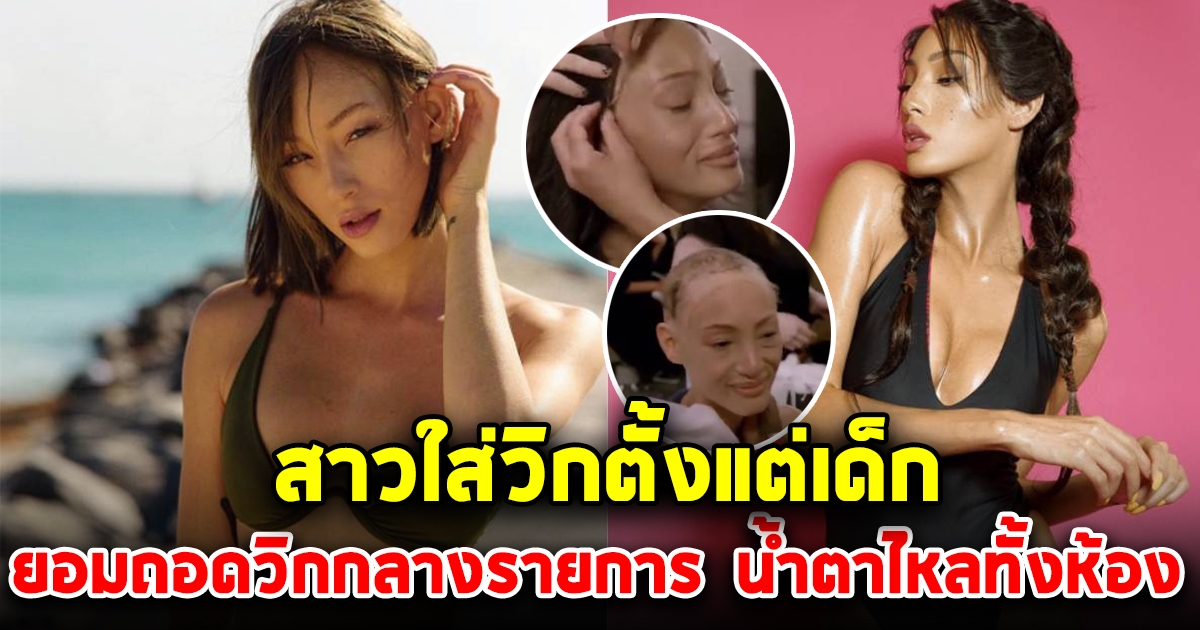 สาว ใส่วิกผม ตั้งแต่เด็ก ล่าสุด ยอมถอดครั้งแรก น้ำตาไหลกันทั้งห้อง