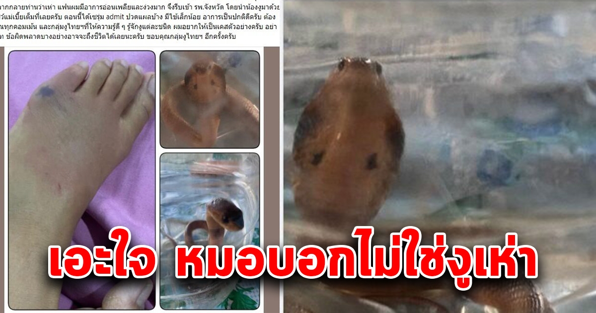 หนุ่มโพสต์ถามภรรยาโดนงูกัด หมอบอกไม่แผ่แม่เบี้ย ให้ยาแก้ปวด-กลับบ้าน เอะใจไปอีกร.พ. ช็อกกันหมด