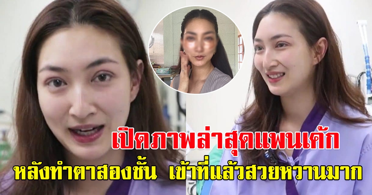 ภาพล่าสุด แพนเค้ก หลังไปทำตามาใหม่ สวยหวานมาก