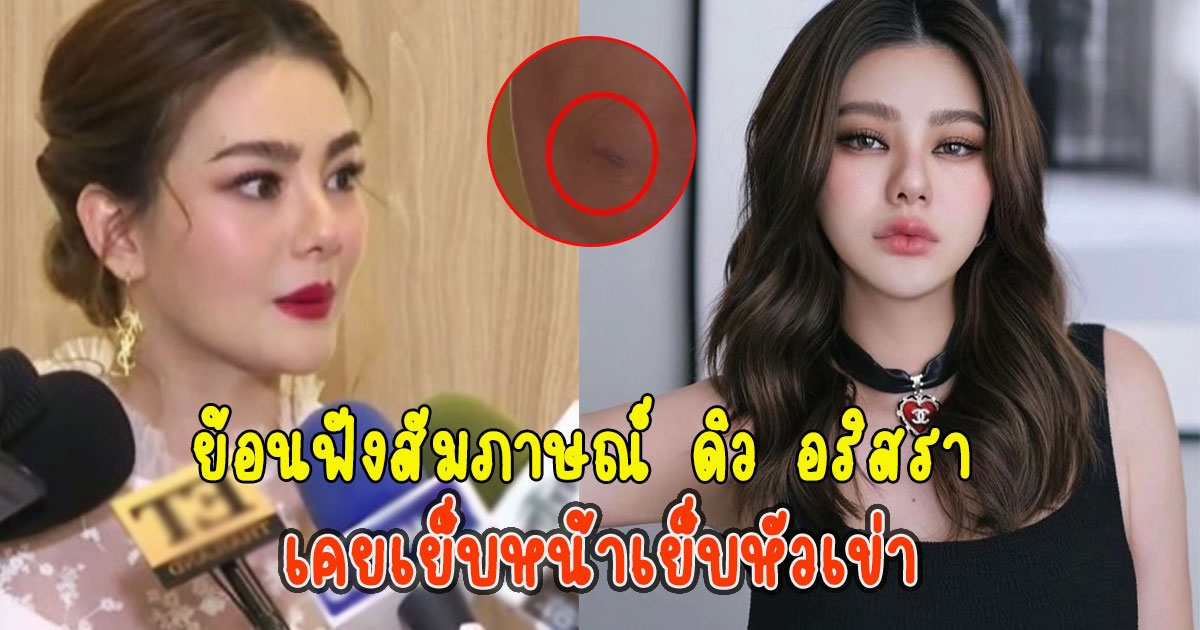 ย้อนฟังสัมภาษณ์ ดิว อริสรา เคยเย็บหน้าเย็บหัวเข่า