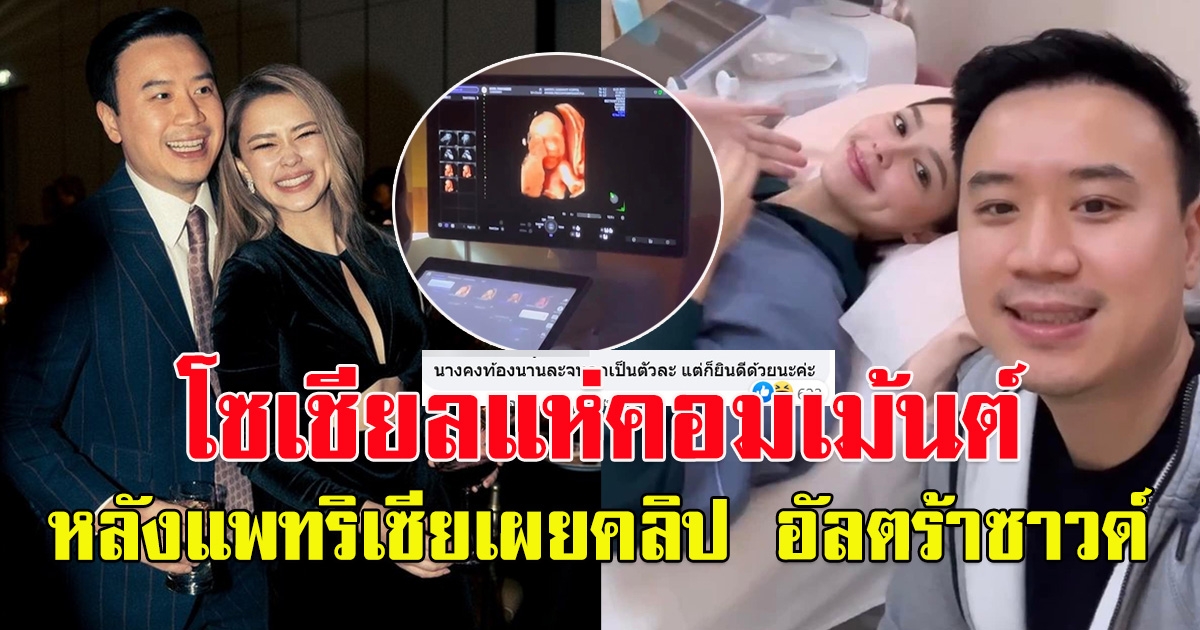 โซเชียลแห่คอมเม้นต์ หลังเห็นคลิป อัลตร้าซาวด์ แพทริเซีย