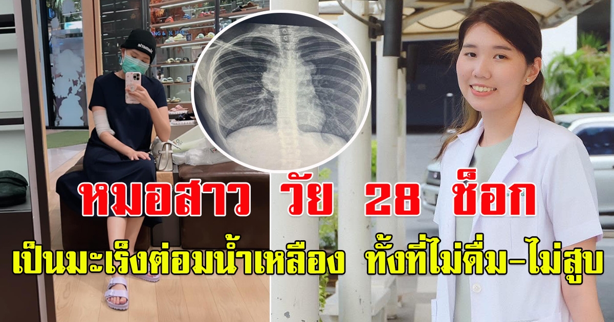 หมอสาว วัย 28 ปี  เป็นมะเร็งต่อมน้ำเหลือง ทั้งที่ไม่ดื่ม-ไม่สูบ