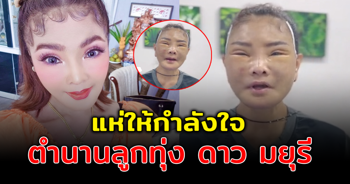 โซเชียลให้กำลังใจ ดาว มยุรี หลังเผยหน้าปัจจุบัน แทบจำไม่ได้