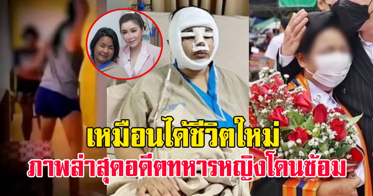 อดีตทหารหญิงรับใช้ เหยื่อซ้อมโหด ส.ต.ท.นุช ล่าสุดศัลยกรรมเหมือนได้ชีวิตใหม่