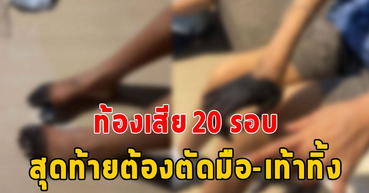 ผัวร้องเมียท้องเสีย 20 รอบ พาไป รพ. นอนไอซียู 10 วัน ไม่รู้รักษายังไง สุดท้ายต้องตัดนิ้วมือ-นิ้วเท้าทิ้งทั้งหมด