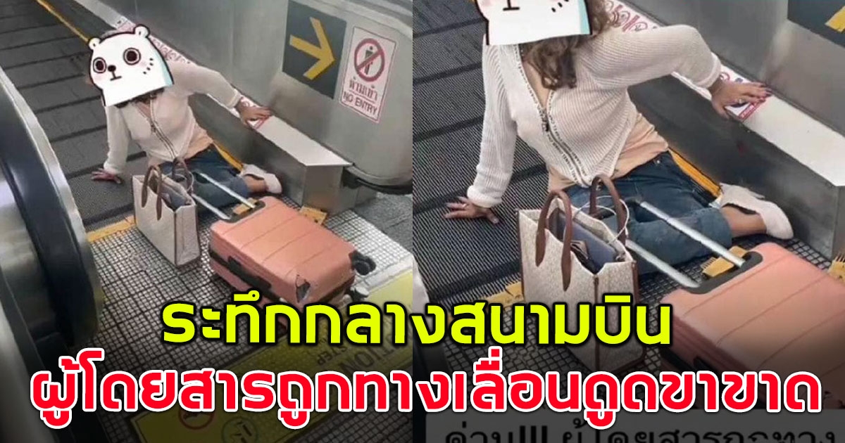 ผู้โดยสาร ถูกทางเลื่อนกลางสนามบินดูดขา เป็นเหตุทำให้ขาซ้ายขาด