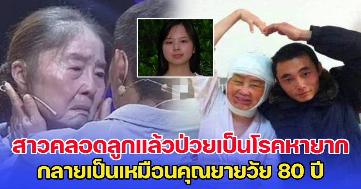 สาวคลอดลูกแล้วป่วยเป็นโรคหายาก กลายเป็นเหมือนคุณยายวัย 80 แต่ทัศนคติสามีน่าชื่นชมมาก ๆ